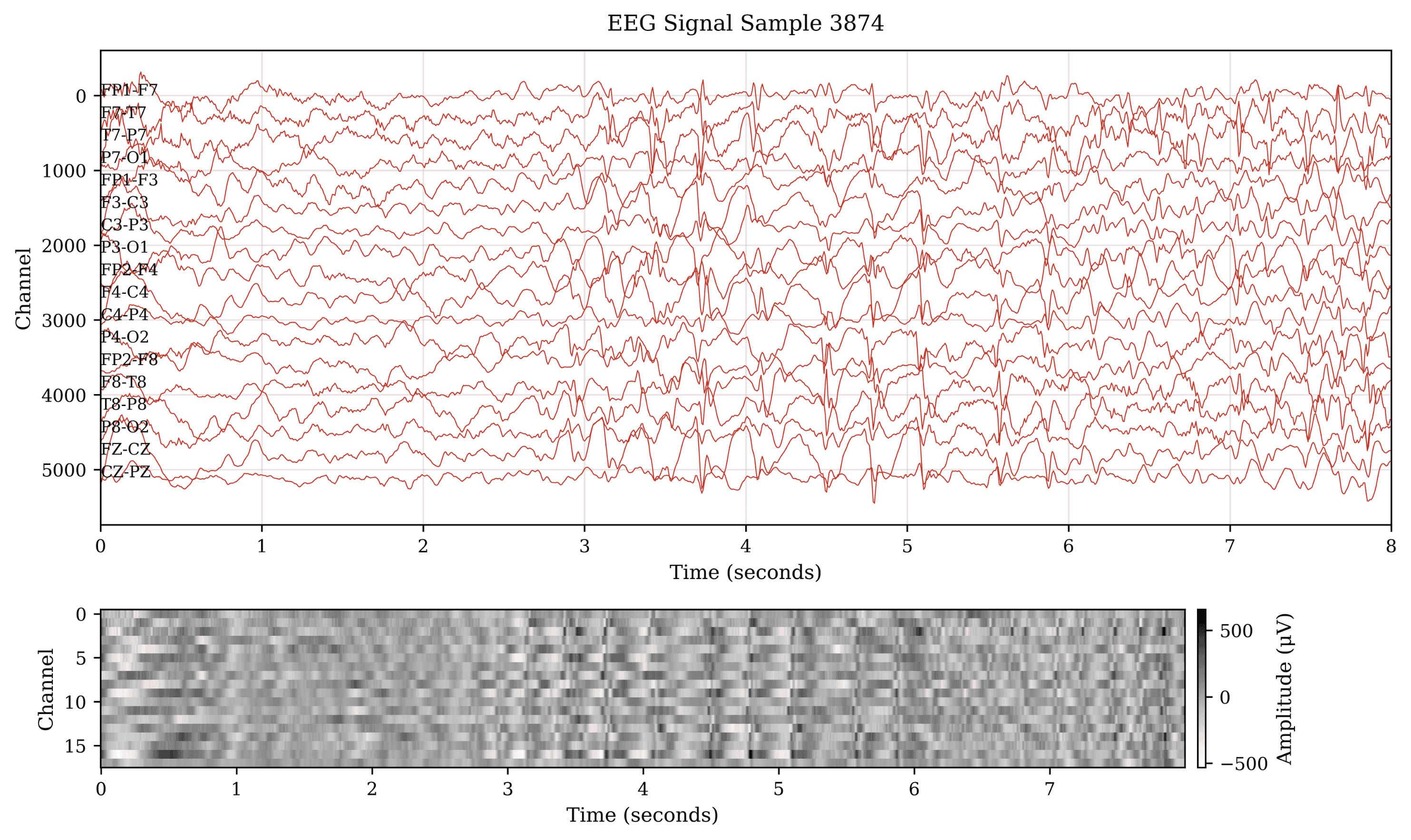 ConvMambaNet: A Hybrid CNN-Mamba State Space Architecture for Accurate and Real-Time EEG Seizure Detection